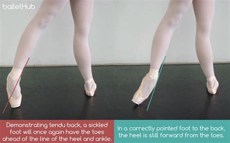 What is Sickling in Ballet and its Dance-Related Subtleties